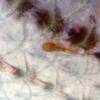 close up sea lice